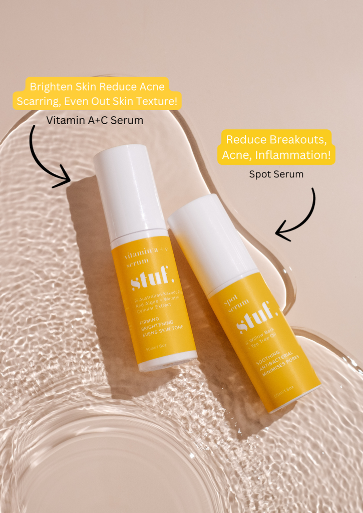 The Acne Kit - 3 Step Clearing Kit for Acne prone skin